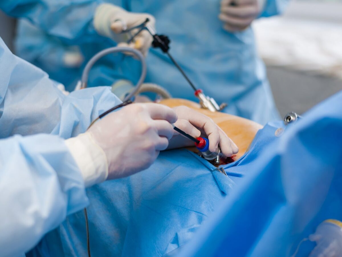 Laparoscopic Surgery